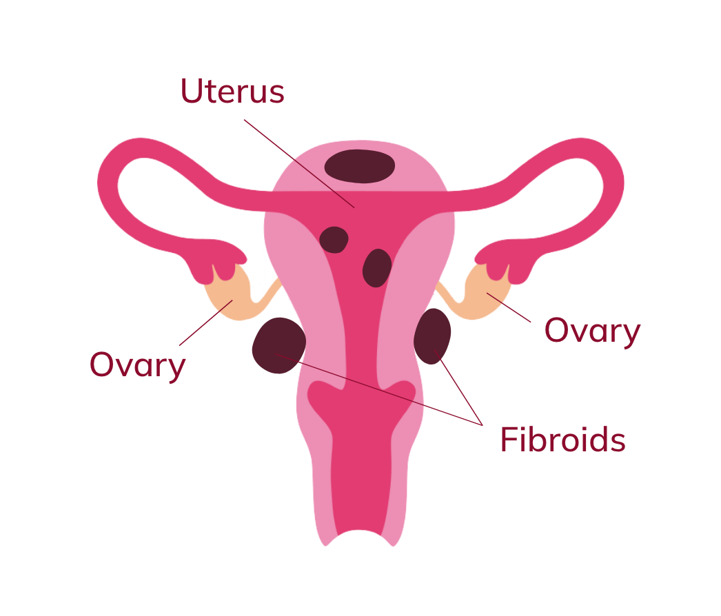 Illustration of a uterus